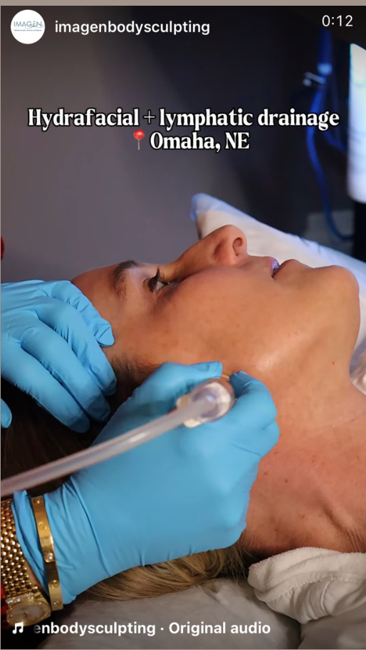 Screenshot of an Imagen facial treatment social media video